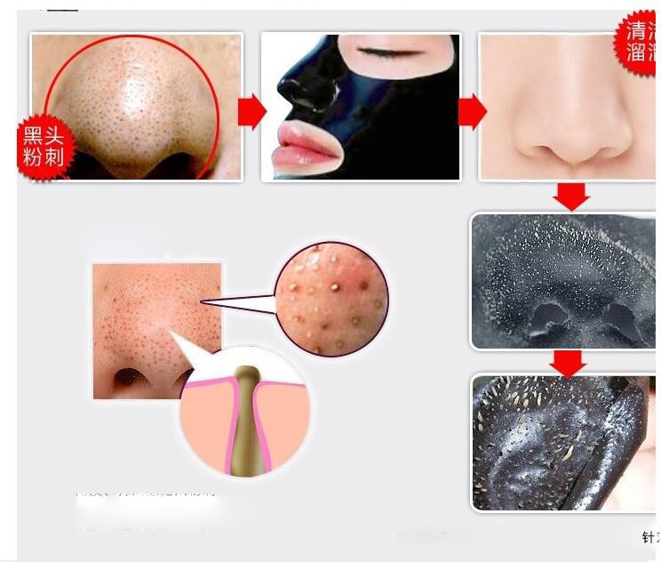 blackhead skin care